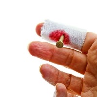 Çivi Geçmiş Parmak Şakası